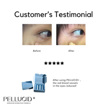 Load image into Gallery viewer, Pellucid + Eye Spray