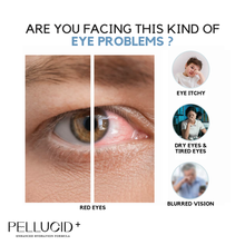Load image into Gallery viewer, Pellucid + Eye Spray
